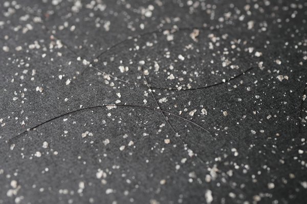 Pellicule grasse : 5 solutions efficaces pour y remédier